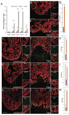 Wnt2bb Induces Cardiomyocyte Proliferation in Zebrafish Hearts via the jnk1/c-jun/creb1 Pathway